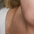 Why is the Thyroid Gland Larger in Females?