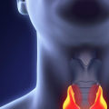 What are the Symptoms of Cancerous Thyroid Nodules?