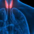 What is the main cause of thyroid problems?