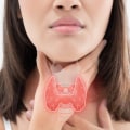Why Women Are More Prone to Thyroid Disease