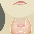 Where Does Thyroid Cancer Spread To?
