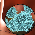 Which Thyroid Cancer Has the Best Prognosis?