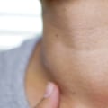 What Causes an Enlarged Thyroid Gland?