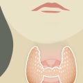 Where Does Thyroid Cancer Metastasize To?