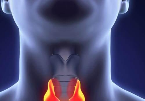 Understanding the Deadly Nature of Anaplastic Thyroid Cancer