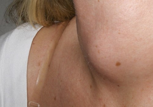 Why Does the Thyroid Gland Move During Swallowing?