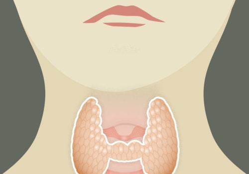 Where Does Thyroid Cancer Spread To?