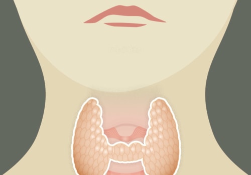 Where Does Thyroid Cancer Spread To?